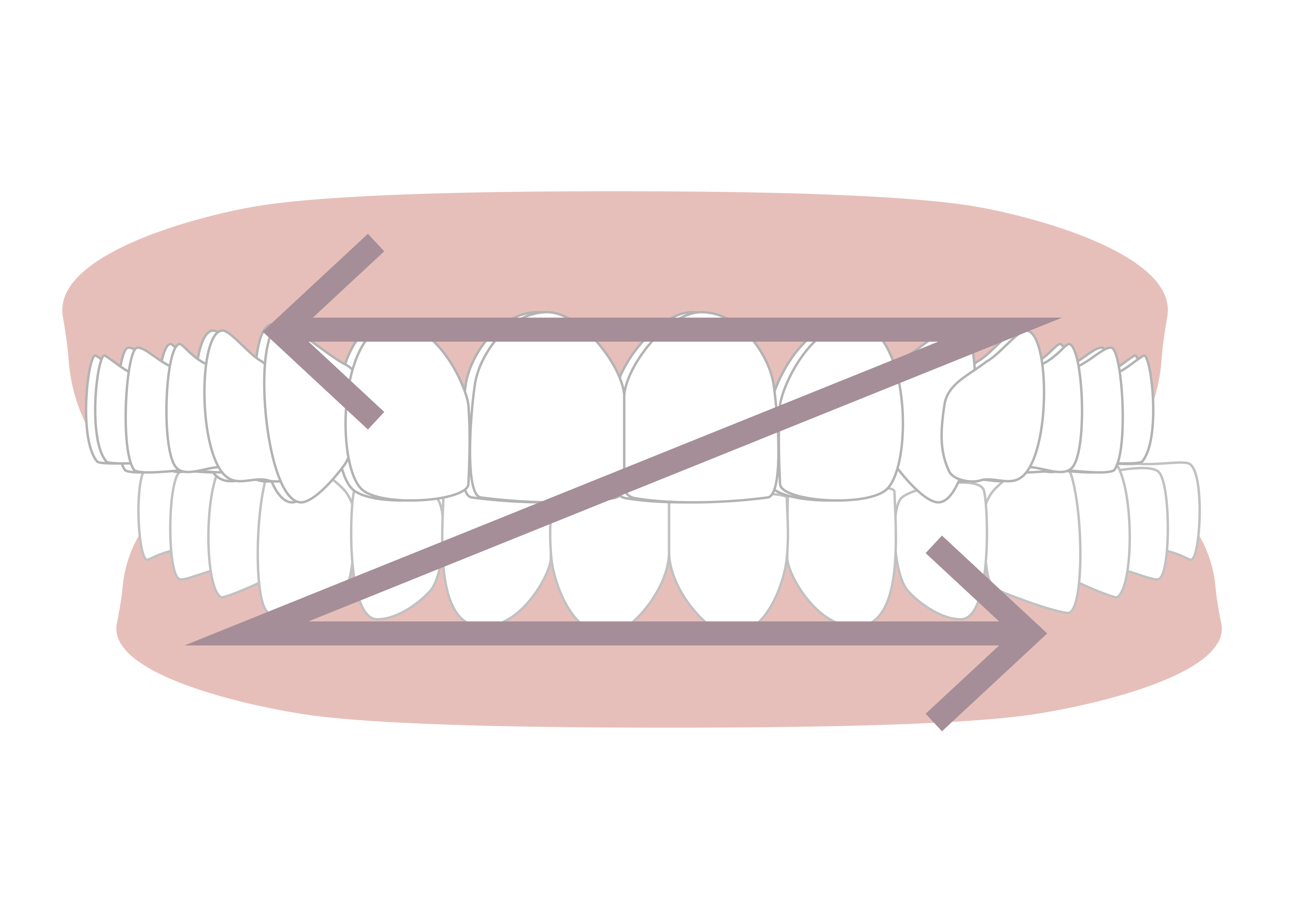 グラインディング