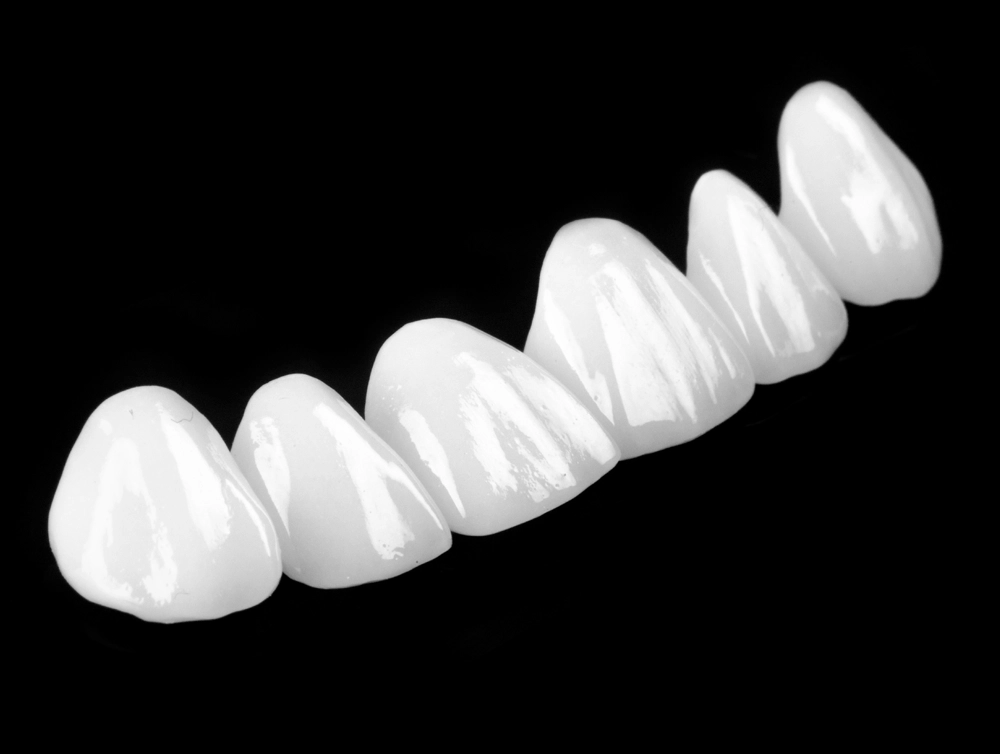 審美歯科・セラミック治療