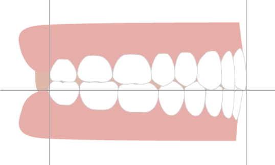 位置関係・噛み合わせ