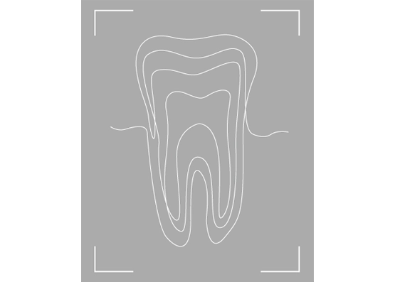 エックス線写真診査