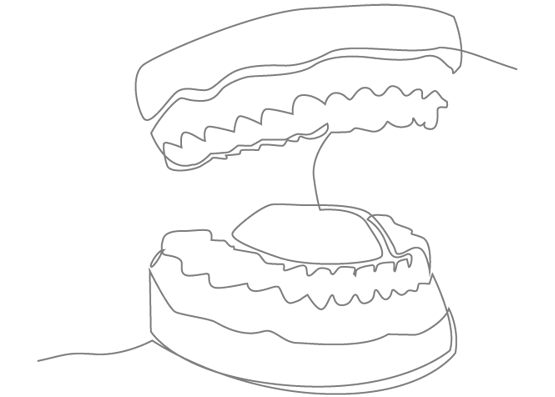 咬み合わせ診断