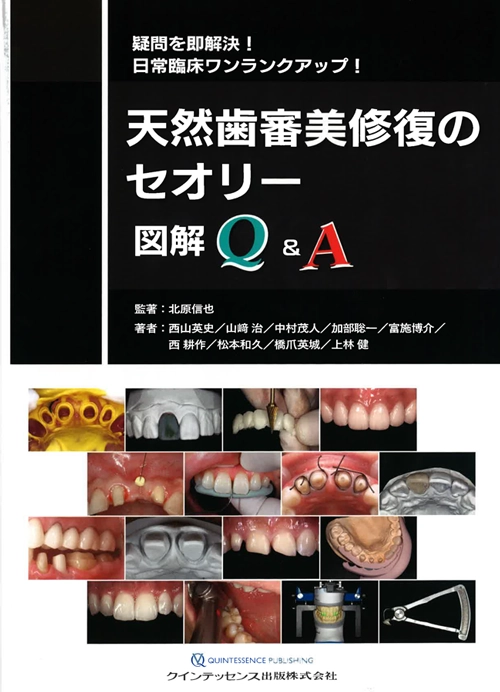 天然歯審美修復のセオリー図解Q&A