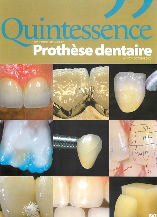 Quintessence Prothese dentaire2007年7月号