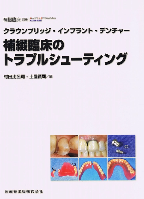 クラウンブリッジ・インプラント・デンチャー 補綴臨床のトラブルシューティング