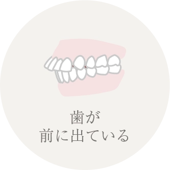 歯が前に出ている