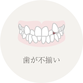 歯が不揃い