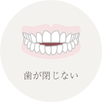 歯が閉じない