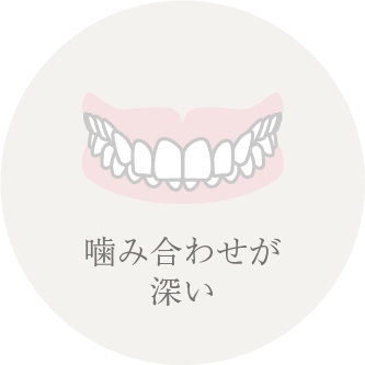 噛み合わせが深い