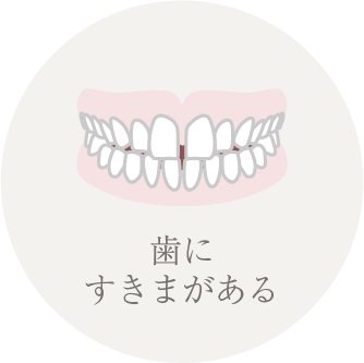 歯にすきまがある