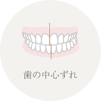 歯の中心ずれ