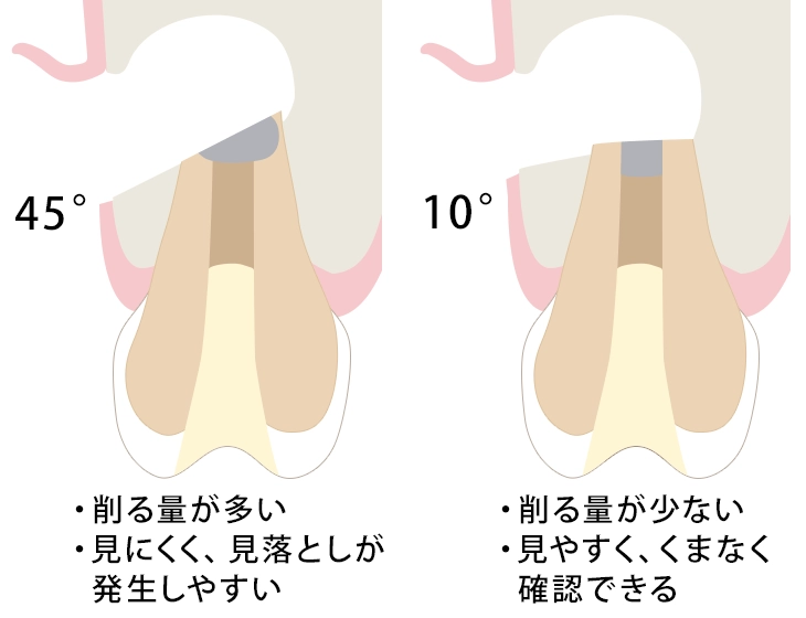 マイクロサージェリー